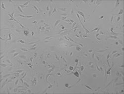 小鼠血管平滑肌细胞原代培养